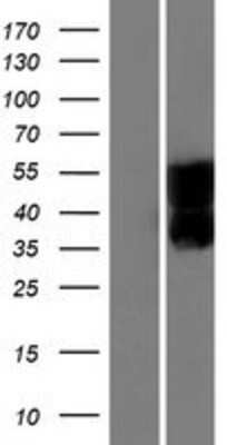 Western Blot: SEZ6L Overexpression Lysate [NBP2-10262]