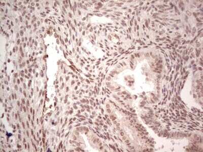 Immunohistochemistry: SF-1/NR5A1/Steroidogenic Factor 1 Antibody (OTI1B4) [NBP2-46247]