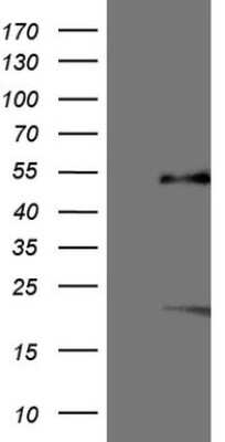 Western Blot: SF-1/NR5A1/Steroidogenic Factor 1 Antibody (OTI1B4) [NBP2-46247]