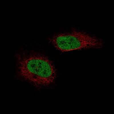 Immunocytochemistry/ Immunofluorescence: SF-1/NR5A1/Steroidogenic Factor 1 Antibody (CL9101) [NBP2-88921]