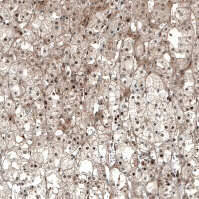 Immunohistochemistry-Paraffin: SF-1/NR5A1/Steroidogenic Factor 1 Antibody (CL9101) [NBP2-88921]