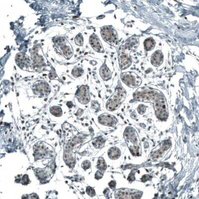 Immunohistochemistry-Paraffin: SF-1/NR5A1/Steroidogenic Factor 1 Antibody (CL9101) [NBP2-88921]