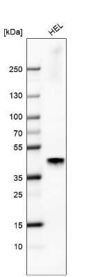 Western Blot: SF-1/NR5A1/Steroidogenic Factor 1 Antibody (CL9101) [NBP2-88921]