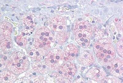 Immunohistochemistry-Paraffin: SF-1/NR5A1/Steroidogenic Factor 1 Antibody [NBP1-52823]