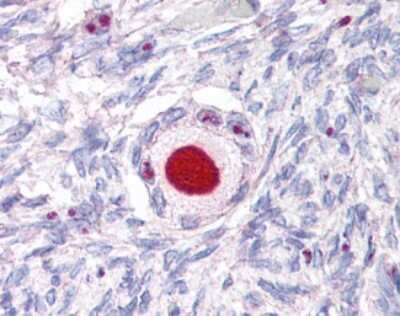 Immunohistochemistry-Paraffin: SF-1/NR5A1/Steroidogenic Factor 1 Antibody - BSA Free [NLS5534]