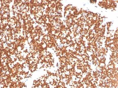 Immunohistochemistry-Paraffin: SF-1/NR5A1/Steroidogenic Factor 1 Antibody (NR5A1/3397) [NBP3-07806]