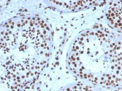 Immunohistochemistry-Paraffin: SF-1/NR5A1/Steroidogenic Factor 1 Antibody (NR5A1/3397) - Azide and BSA Free [NBP3-08624]