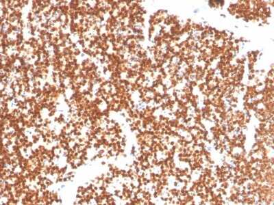 Immunohistochemistry-Paraffin: SF-1/NR5A1/Steroidogenic Factor 1 Antibody (NR5A1/3397) - Azide and BSA Free [NBP3-08624]