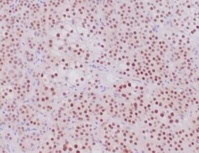 Immunohistochemistry-Paraffin: SF-1/NR5A1/Steroidogenic Factor 1 Antibody (NR5A1/4368R) [NBP3-13917]