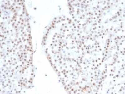 Immunohistochemistry-Paraffin: SF-1/NR5A1/Steroidogenic Factor 1 Antibody (NR5A1/4368R) [NBP3-13917]