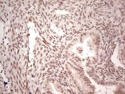 Immunohistochemistry: SF-1/NR5A1/Steroidogenic Factor 1 Antibody (OTI1B4) - Azide and BSA Free [NBP2-74149]