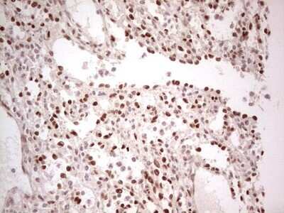 Immunohistochemistry: SF-1/NR5A1/Steroidogenic Factor 1 Antibody (OTI1B4) - Azide and BSA Free [NBP2-74149]