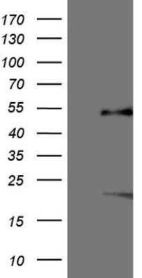 Western Blot: SF-1/NR5A1/Steroidogenic Factor 1 Antibody (OTI1B4)Azide and BSA Free [NBP2-74149]