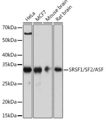 Western Blot: SF2 Antibody (3J5Q9) [NBP3-16329]