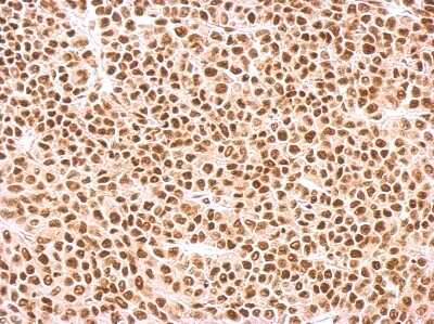 Immunohistochemistry-Paraffin: SF2 Antibody [NBP2-20324]