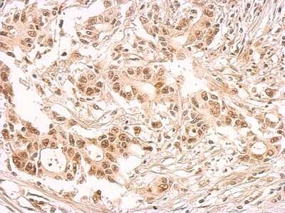 Immunohistochemistry-Paraffin: SF2 Antibody [NBP2-20324]