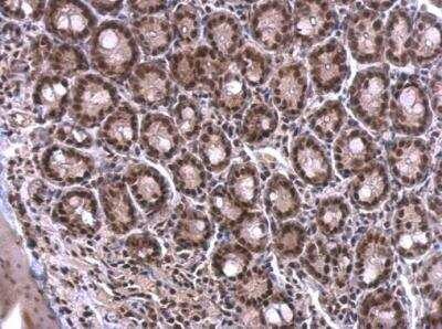 Immunohistochemistry-Paraffin: SF2 Antibody [NBP2-20324]