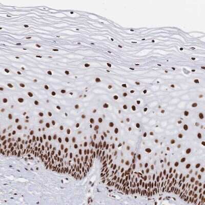 Immunohistochemistry-Paraffin: SF2 Antibody [NBP2-38912]