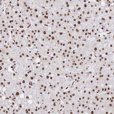 Immunohistochemistry-Paraffin: SF2 Antibody [NBP2-38912]