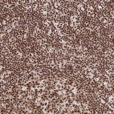 Immunohistochemistry-Paraffin: SF2 Antibody [NBP2-38912]