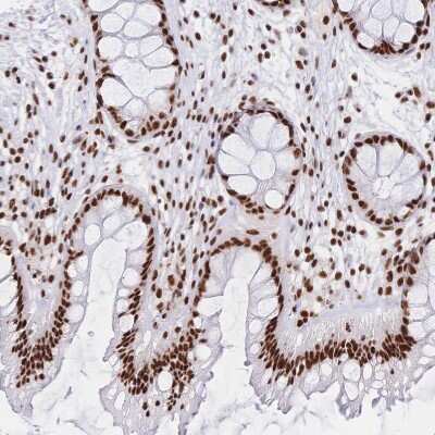 Immunohistochemistry-Paraffin: SF2 Antibody [NBP2-38912]