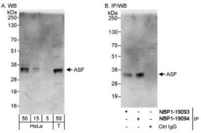 Western Blot: SF2 Antibody [NBP1-19093]