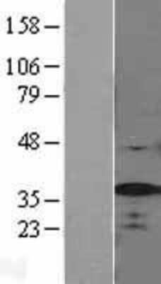 Western Blot: SF2 Overexpression Lysate [NBL1-15886]