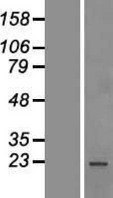 Western Blot: SF2 Overexpression Lysate [NBP2-10637]