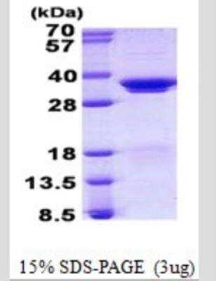 SDS-PAGE: Recombinant Human SF2 His Protein [NBP2-53109]