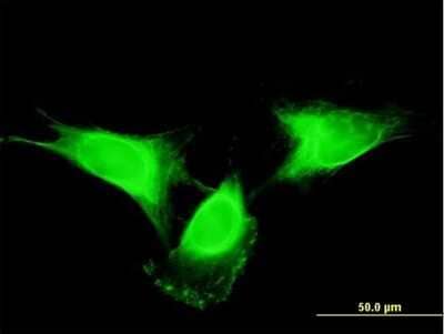 Immunocytochemistry/ Immunofluorescence: SF20/MYDGF Antibody (2D4) [H00056005-M03]