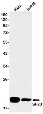 Western Blot: SF20/MYDGF Antibody (S06-7B1) [NBP3-20063]