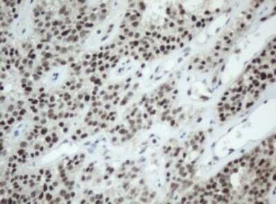 Immunohistochemistry: SF3A1 Antibody (OTI3F4) [NBP2-45803]
