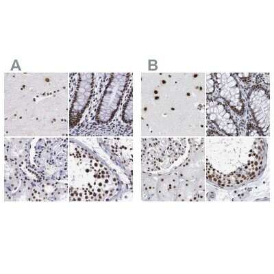 Immunohistochemistry-Paraffin: SF3A1 Antibody [NBP1-87214]