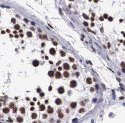 Immunohistochemistry-Paraffin: SF3A1 Antibody [NBP1-87214]