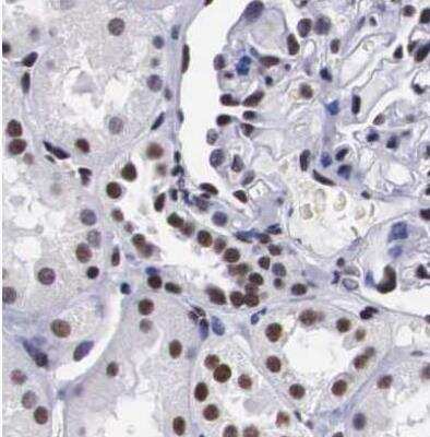 Immunohistochemistry-Paraffin: SF3A1 Antibody [NBP1-87214]