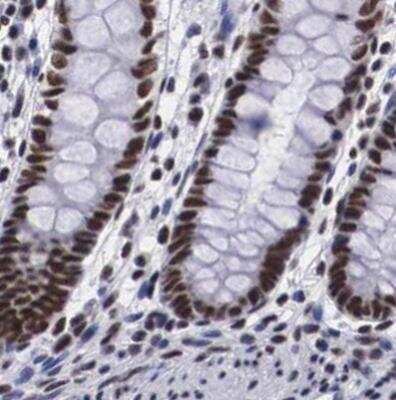 Immunohistochemistry-Paraffin: SF3A1 Antibody [NBP1-87214]