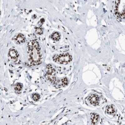 Immunohistochemistry-Paraffin: SF3A1 Antibody [NBP1-87215]
