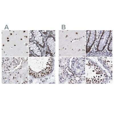 Immunohistochemistry-Paraffin: SF3A1 Antibody [NBP1-87215]