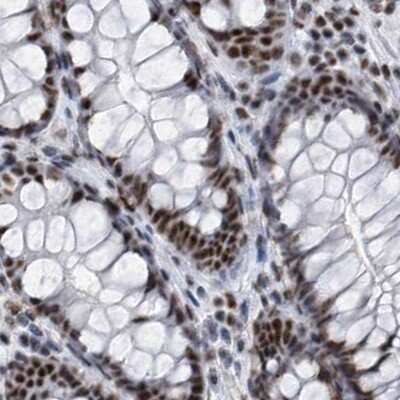 Immunohistochemistry-Paraffin: SF3A1 Antibody [NBP1-87215]
