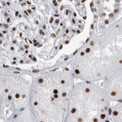 Immunohistochemistry-Paraffin: SF3A1 Antibody [NBP1-87215]