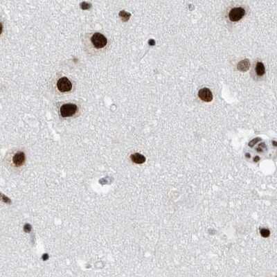 Immunohistochemistry-Paraffin: SF3A1 Antibody [NBP1-87215]