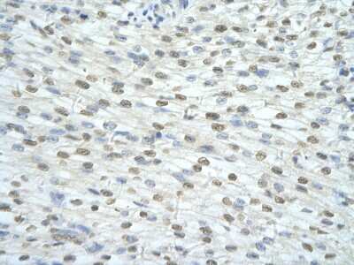 Immunohistochemistry-Paraffin: SF3A1 Antibody [NBP3-10539]