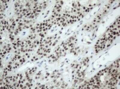 Immunohistochemistry: SF3A1 Antibody (OTI3F4) - Azide and BSA Free [NBP2-74150]