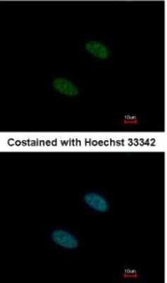 Immunocytochemistry/ Immunofluorescence: SF3A2 Antibody [NBP2-15106]