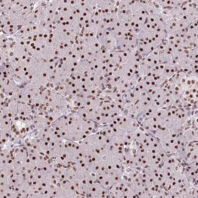 Immunohistochemistry: SF3A2 Antibody [NBP2-47281]