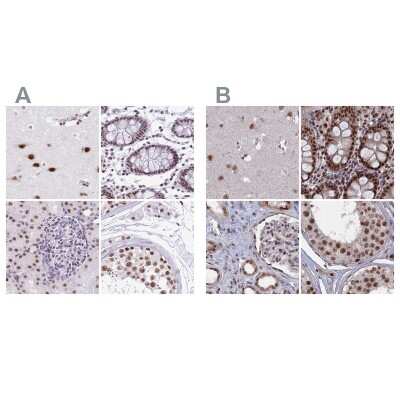 Immunohistochemistry-Paraffin: SF3A2 Antibody [NBP2-47281]