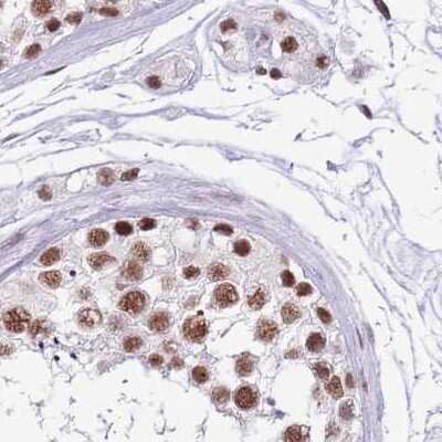 Immunohistochemistry-Paraffin: SF3A2 Antibody [NBP2-47281]