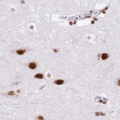 Immunohistochemistry-Paraffin: SF3A2 Antibody [NBP2-47281]