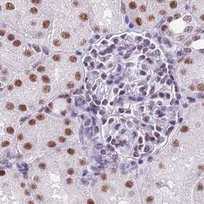 Immunohistochemistry-Paraffin: SF3A2 Antibody [NBP2-47281]