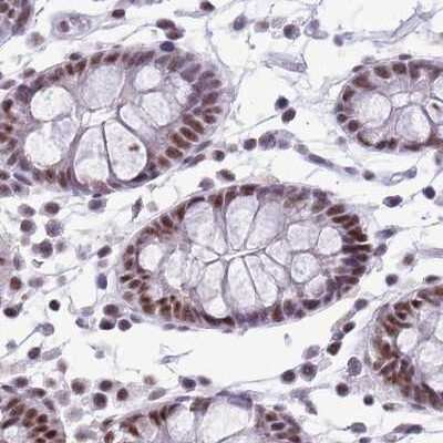 Immunohistochemistry-Paraffin: SF3A2 Antibody [NBP2-47281]